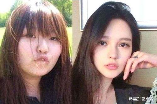 娱乐圈整容普遍吗,普遍还是个例？