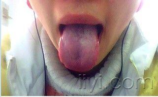 舌部的照片,探寻健康密码的视觉之旅